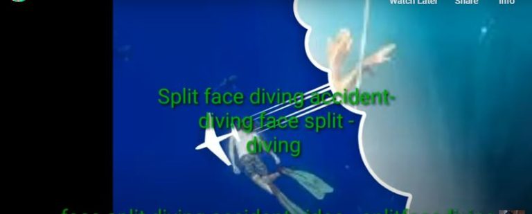 Trending: split face diving accident, Why you should avoid it